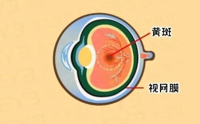 愛爾眼科：激光“打”在眼內還能治眼病？(圖3)