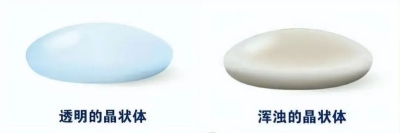 愛爾眼科：白內(nèi)障不會“缺席”只會“遲到”？(圖3)