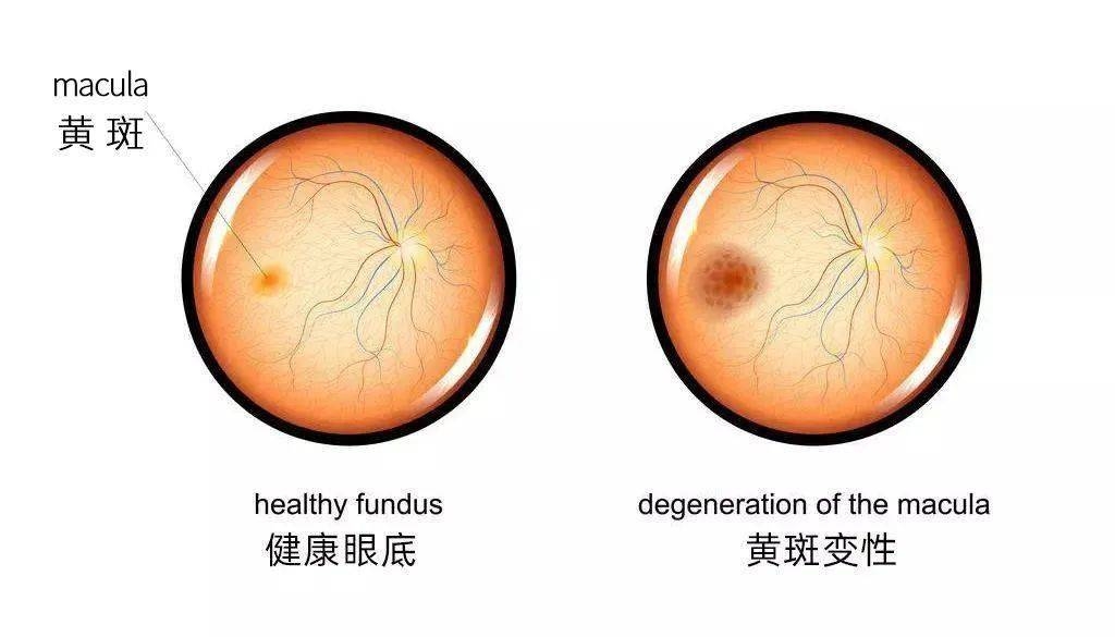 葉黃素對眼睛真的有效嗎？一文讀懂它的功效與作用(圖3)